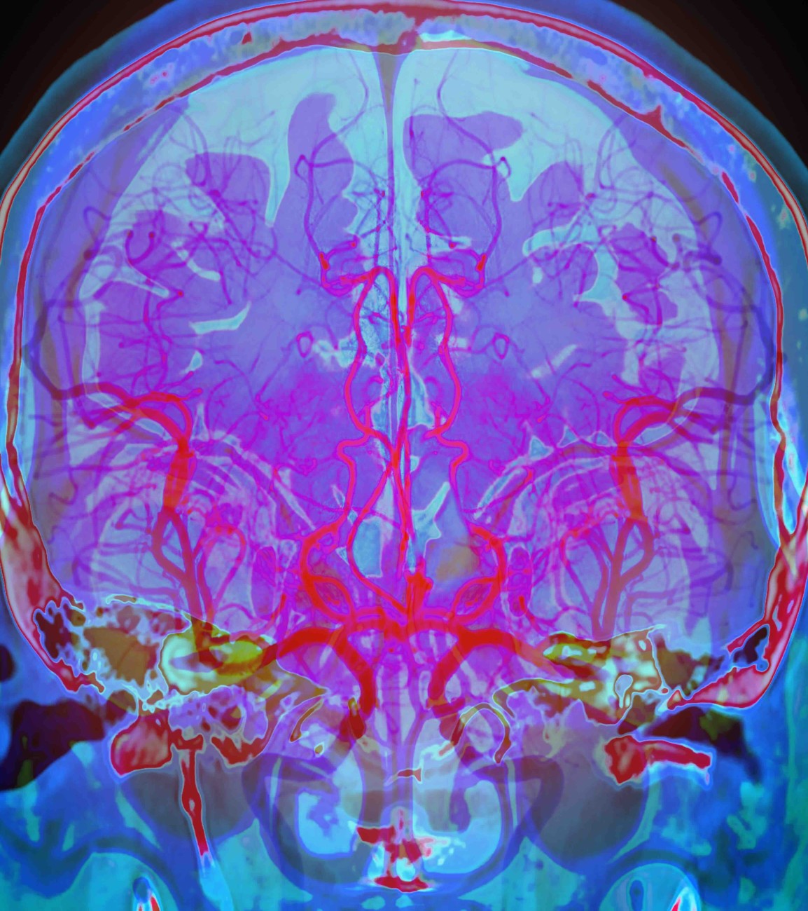 Brain scanning methods | Paris Brain Institute