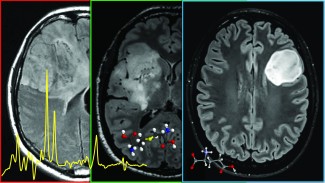 Imagerie médicale