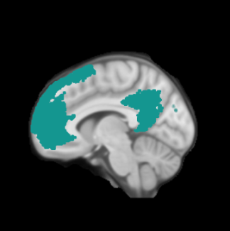 Frontlab DFT