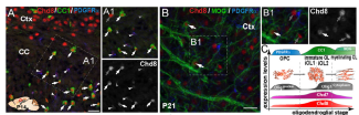 A, A1, B, B1 : Expression de la protéine Chd8 (marquée en rouge) dans les oligodendrocytes en cours de maturation ou matures (flèches blanches) et dans les neurones (flèches grises). C : Spectre de l’expression de la protéine Chd8 au cours de la maturation des oligodendrocytes.