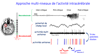 Approche multi niveaux de l'activite intracerebrale