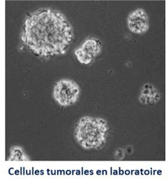 Cellules tumorales en laboratoire