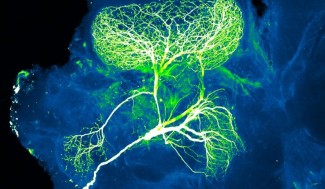 Projection d’un neurone. Crédit : NICHD/N. Gupt