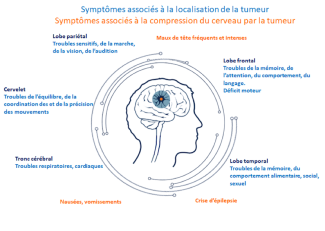 Symptômes associés à la localisation de la tumeur