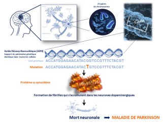 Schéma de la maladie de Parkinson