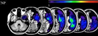 Cerveau et attention spatiale