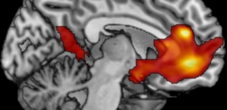 En jaune-orangé apparaissent les régions du cerveau qui représentent les jugements de valeur : plus quelque chose nous plaît, plus le signal augmente dans les mesures par IRM fonctionnelle