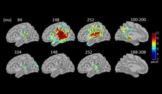 Les signaux témoignant d’une erreur de prédiction, la partie intermédiaire de la MMN et la P300, disparaissent dans le sommeil. Seuls les mécanismes passifs d’adaptation sensorielle (les parties précoces et tardives de la MMN), confinés aux aires auditives, persistent. (Les différents temps sont exprimés en millisecondes, ils mesurent le délai de réponse au son.