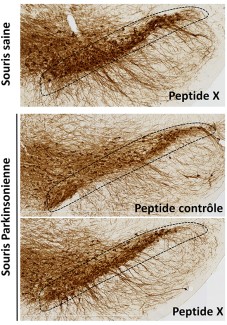 L’administration intranasale du Peptide X protège contre la neurodégénérescence dans un modèle animal de la maladie de Parkinson © Yann Monnet/Marion Szelechowski – Nature Communications