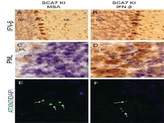 The interferon beta treated mouse cerebellum shows some modifications within Purkinje cells involved in the SCA7 pathology.