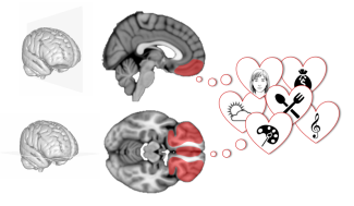 Four core properties of the human brain valuation system demonstrated in intracranial signals