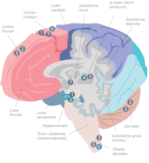 Maladies neurodegeneratives communes