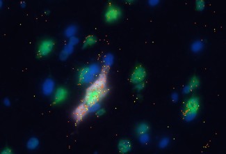 Analyse MERSCOPE