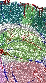 reconstruction of a cerebral vascular network