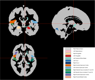 Régions cérébrales d’intérêt pour prédire la dépression. Crédit : Elise Delzant.