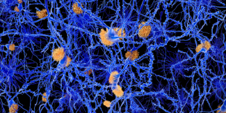Experimental and Computational Advances on APP and Amyloid-β Research 