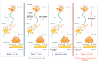 icm_epilepsie_en