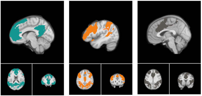 Creativity | Paris Brain Institute