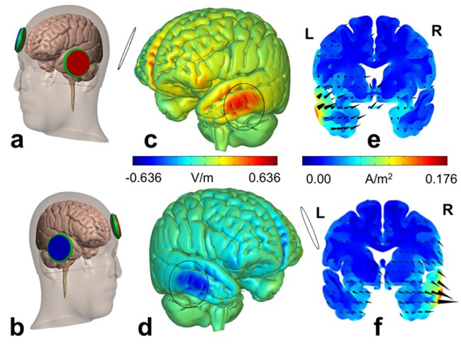 cerveau