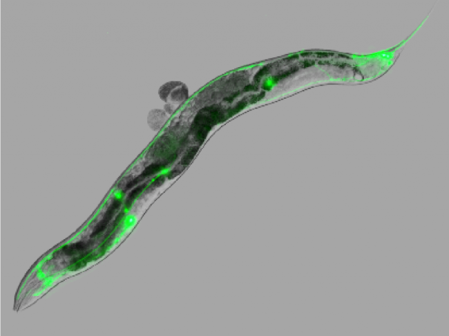 Image d’un nématode (C. elegans) exprimant la protéine prion humaine dans le système mécanosensitif (vert)