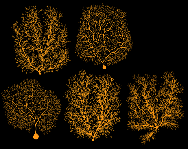Ataxias | Paris Brain Institute