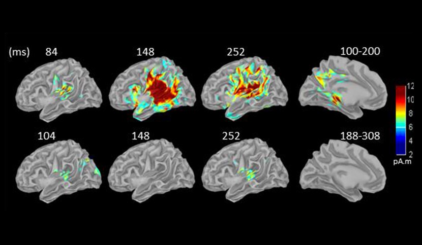 Sleep reduces the brain's capacity to predict | Paris Brain Institute